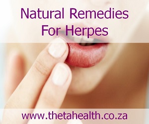 Natural Remedies for Herpes